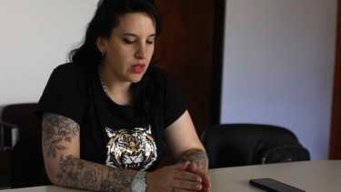 Romina indicó que se quiere dedicar a cubrir cicatrices. Foto: Juan Thomes