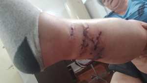 Preocupan las mordeduras de los perros sueltos en Bariloche