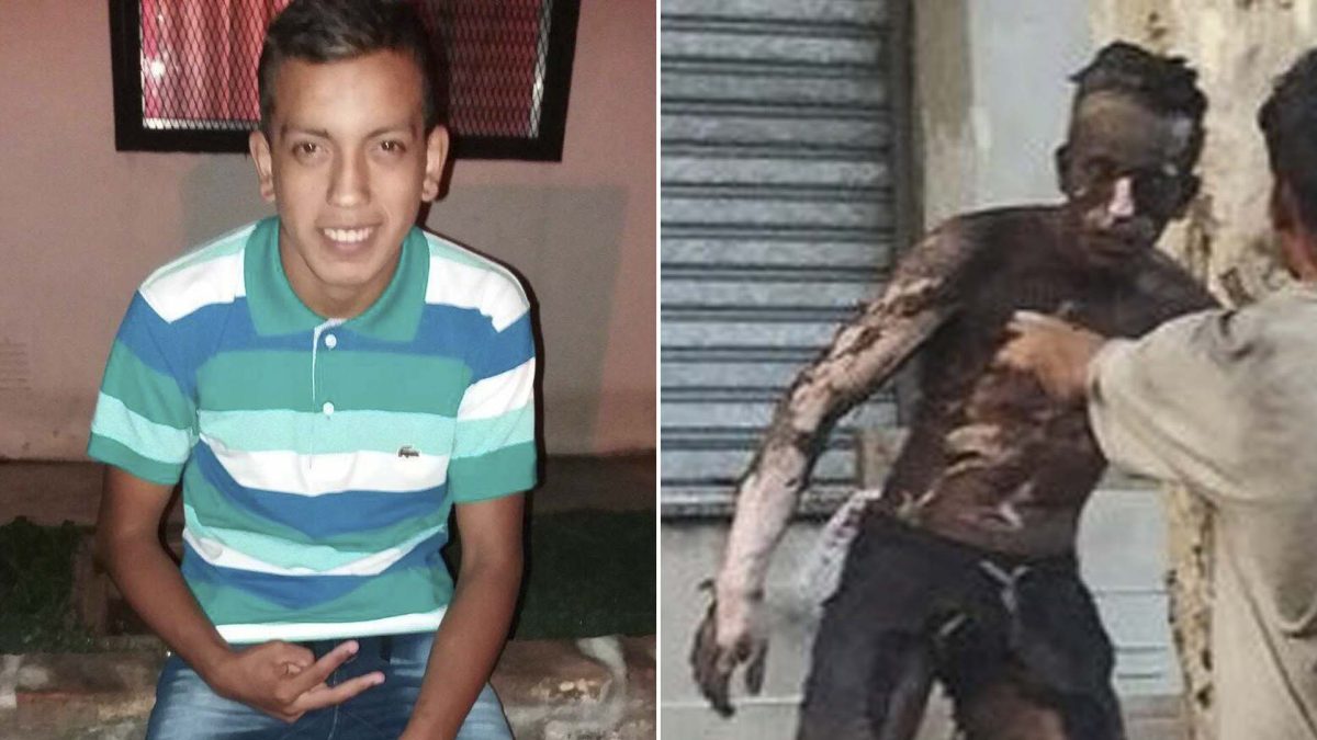 Quién es el joven de Rosario que terminó con el 90% del cuerpo quemado, en un intento de robo de cables