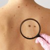 Imagen de Hito en la medicina: la primera vacuna de ARN contra el cáncer supera con éxito la fase final