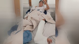 Sumate: Joaquín se quebró en el Mundialito y necesita tu ayuda para una operación