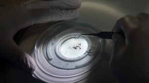 Dengue: dio negativo el paciente de Roca pero el caso todavía no se cierra, falta un paso más