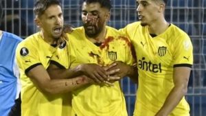 Escándalo en Rosario: un jugador de Peñarol terminó herido y Central se expone a una dura sanción