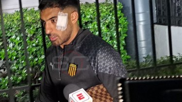 Maximiliano Olivera dejó el sanatorio con un apósito en la cara tras los incidentes con los hinchas de Rosario Central.