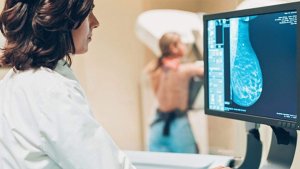 Cáncer de mama: Por qué es importante la mamografía anual a partir de los 40