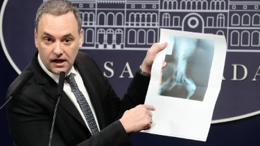 Escándalo con Pensiones No Contributivas (PNC): Adorni denunció corrupción en las prestaciones por invalidez