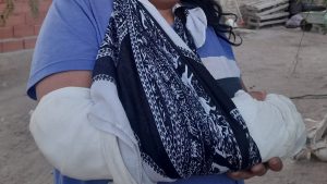 Video | El brutal ataque de un perro pitbull y un dogo a una mujer de Cinco Saltos: sufrió una fractura