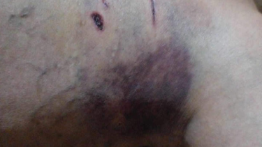 Jauría de perros atacó brutalmente a una mujer mientras caminaba en Viedma (Foto: gentileza)