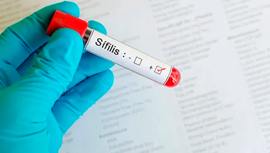 Sífilis. Foto: archivo
