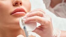 Imagen de Ácido hialurónico: alertan sobre los riesgos de este relleno que es tendencia entre los más jóvenes