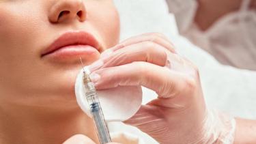 Ácido hialurónico: alertan sobre los riesgos de este relleno que es tendencia entre los más jóvenes