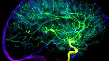 En Neuquén se sancionó una ley en 2020 para promover el acceso al diagnóstico y al tratamiento oportuno.
 