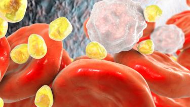 Una mala alimentación puede ser desencadenante de niveles no deseados de colesterol. Foto gentileza. 