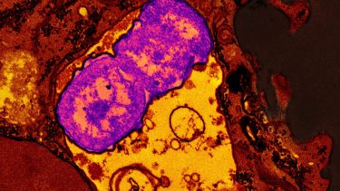 El 26 de septiembre se tratará el grave problema en la sede de ONU en Nueva York.
