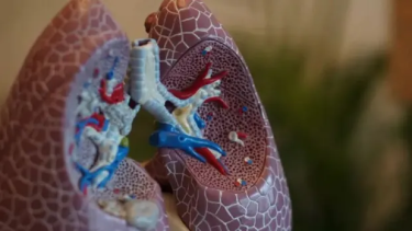 Un nuevo tratamiento que puede ayudar a pacientes con fibrosis quística