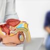 Imagen de Cáncer de próstata: cuáles son los síntomas, los factores de riesgo y cuándo hacerse los controles