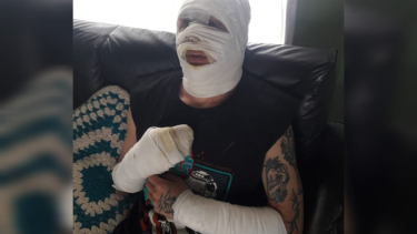 El hombre sufrió un accidente laboral. Foto: gentileza.