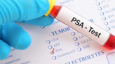 Estudios de PSA gratuitos en Roca