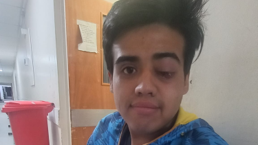 Golpiza en las 827 viviendas: joven necesita $3,5 millones cirugía millonaria para salvar su ojo. Foto Gentileza.