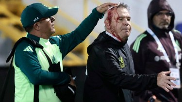 Aguirre DT de México, fue herido tras la derrota de su equipo. (Jhony Magallanes)