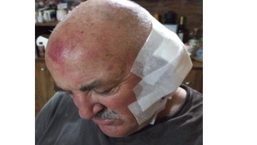 El hombre estaba trabajando cuando el joven lo golpeó con un caño. (Gentileza)