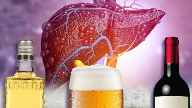 El consumo excesivo de alcohol no solo afecta al hígado, sino que compromete la calidad de vida en general. La prevención y el conocimiento son claves para evitar consecuencias graves a futuro.

