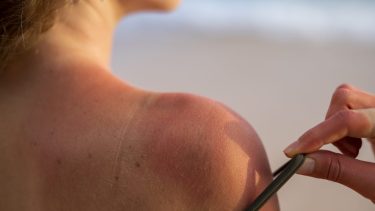 Al mediodía, entre las 12 y las 14 horas, la radiación solar tiene su mayor impacto. 