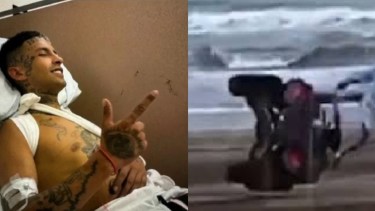 L-gante deberá ser operado.