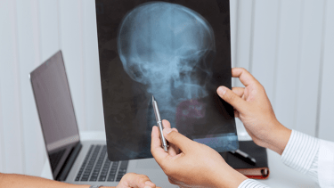 La Justicia de Río Negro ordenó a la obra social cubrir la cirugía ortognática de una paciente tras negarle la prestación.  
