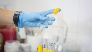 El laboratorio de Bromatología de Bariloche realiza análisis que cuestan tres veces menos que en los privados