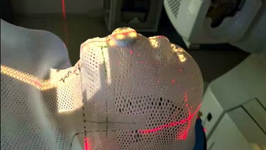 El DDL permite inmovilizar el torso y la cabeza, con el depresor, en una misma unidad, sin que afecte la respiración del paciente con cáncer - Foto: Gentileza. 