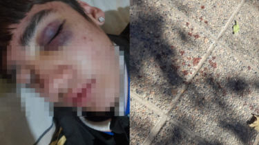 Un adolescente recibió una brutal paliza en Cinco Saltos.
