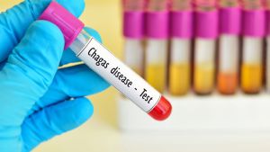 Chagas: alertan que uno de cada cien embarazos registra exposición al parásito