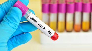 En zonas de alta incidencia, como el noroeste argentino, la realización de exámenes de laboratorio es fundamental para detectar el contagio en etapas tempranas y evitar complicaciones mayores.

