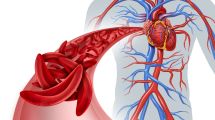 Imagen de La verdura económica que recomiendan para controlar la presión arterial