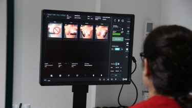 El equipo elimina la necesidad de trasladarse grandes distancias para acceder a estudios de mamografía.