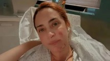 Imagen de María Julia Oliván habló de su recuperación tras sufrir un terrible accidente con una estufa