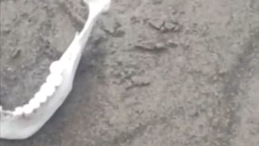 Aseguran haber encontrado huesos humanos en Neuquén: qué dijo el Gobierno y qué hacer