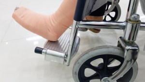 Indemnización millonaria en Río Negro: se quebró en un choque que le cambió la vida y la Justicia falló a su favor