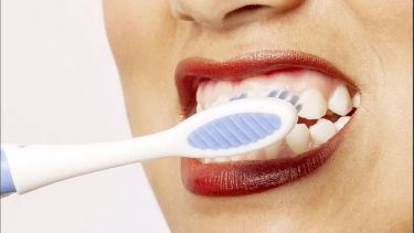 Prohíben una famosa marca de productos para blanquear los dientes: qué dijo ANMAT
