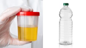 El increíble descubrimiento que lograron al mezclar vinagre con orina: el uso que tiene según la ciencia 