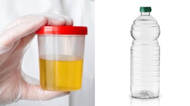 El increíble descubrimiento que lograron al mezclar vinagre con orina: el uso que tiene según la ciencia 