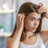 Imagen de ¿Se te cae el pelo? Lo que tenés que saber
