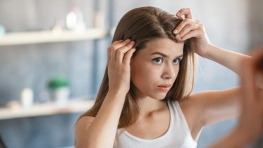 ¿Se te cae el pelo? Lo que tenés que saber