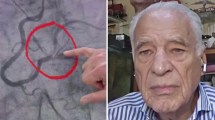 Imagen de Alberto Cormillot fue hospitalizado y le colocaron un stent de urgencia
