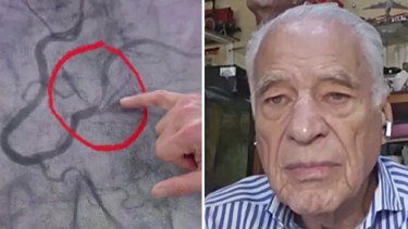 Alberto Cormillot fue hospitalizado y le colocaron un stent de urgencia