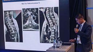 Más de 300 cirujanos compartieron en Bariloche los últimos avances en cirugía espinal