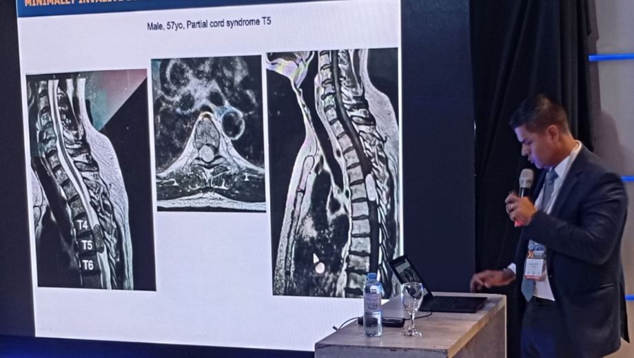 Más de 300 especialistas de todo el mundo participaron de los congresos de cirugía de columna en Bariloche. Fotos gentileza. 