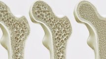Imagen de Cómo funciona la nueva técnica que busca revertir el avance de la osteoporosis
