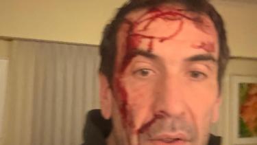 Violento asalto al candidato de LLA, Pablo Cervi: «Neuquén zona liberada. El 101 no funciona»